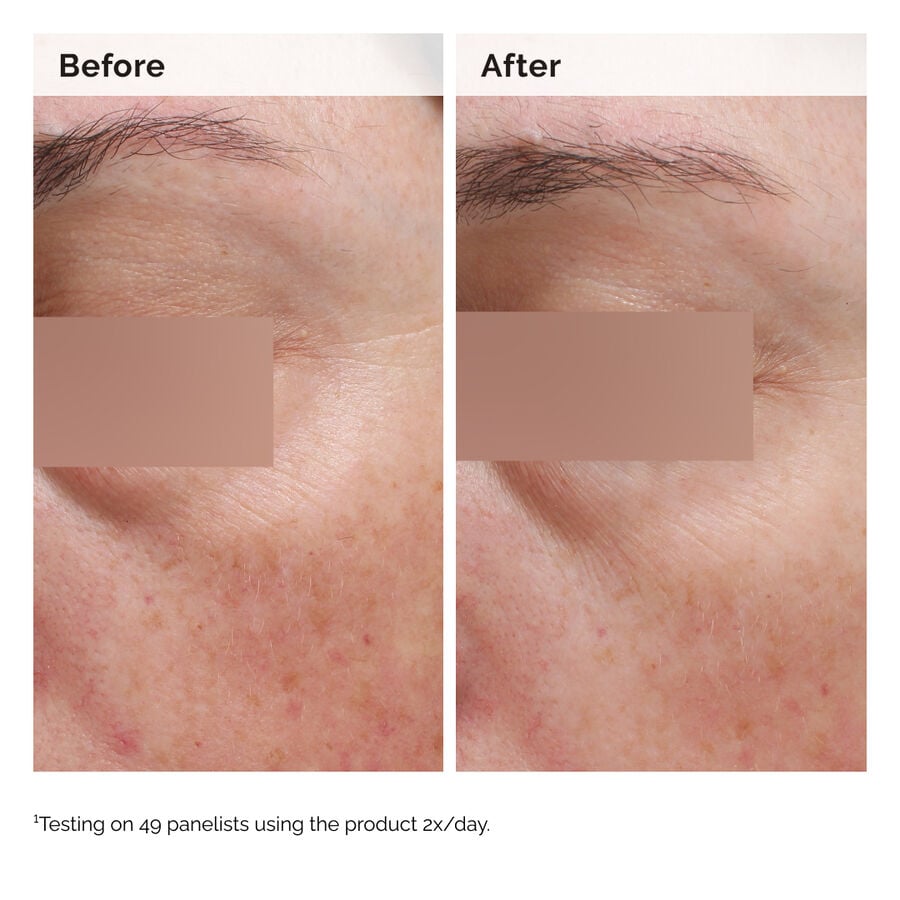 niacinamide-5-face-and-body-emulsion-q8 2024-08-23-ORD-Nia-5pct-Face-Body-B-A-Elasticity-Global-02-1x1.jpg