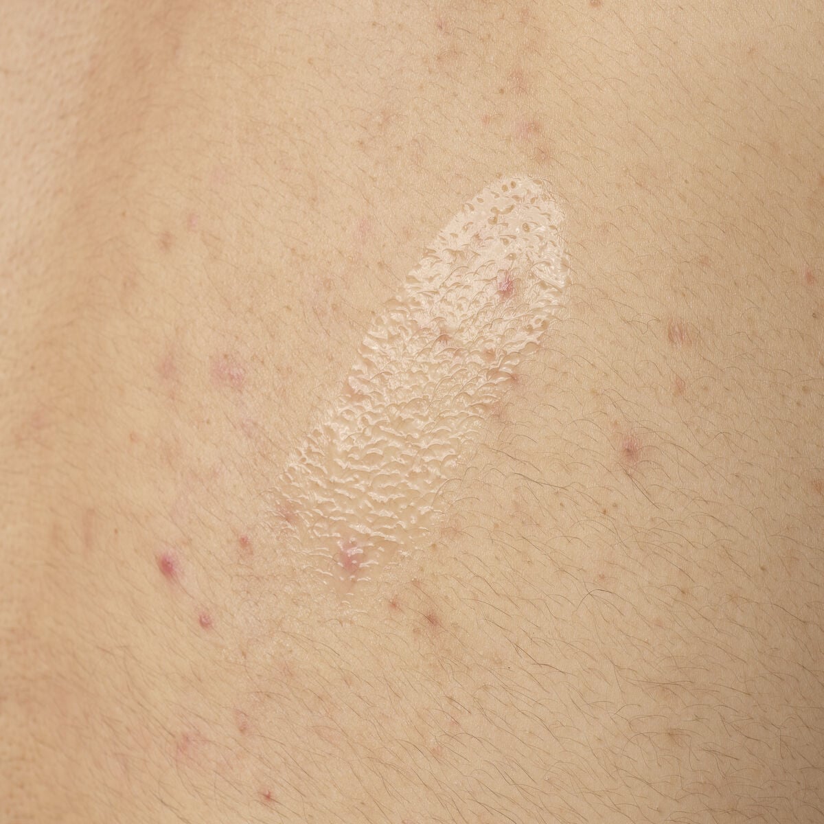 salicylic-acid-0-5-body-serum-u1 ORD-salicylic-acid-05-body-240ml-application.jpg