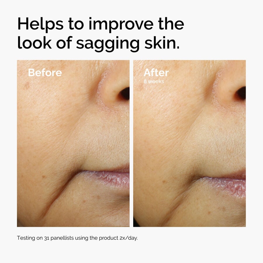 caffeine-3-escin-1-face-serum-i6 ord-caffeine-3pct-escin-1pct-face-serum-before-after-sagging.jpg