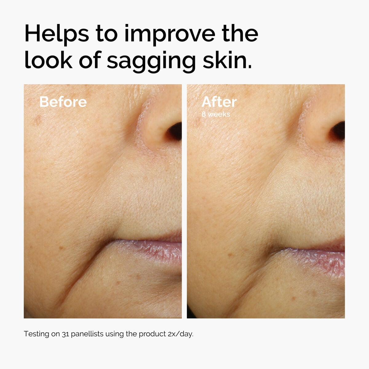 caffeine-3-escin-1-face-serum-i6 ord-caffeine-3pct-escin-1pct-face-serum-before-after-sagging.jpg