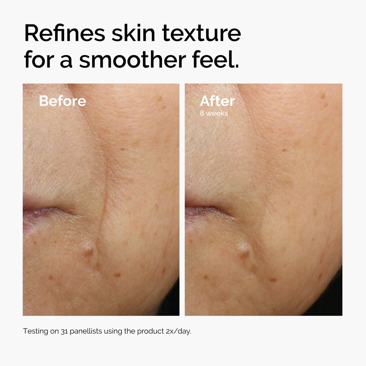 caffeine-3-escin-1-face-serum-i6 ord-caffeine-3pct-escin-1pct-face-serum-before-after-texture.jpg