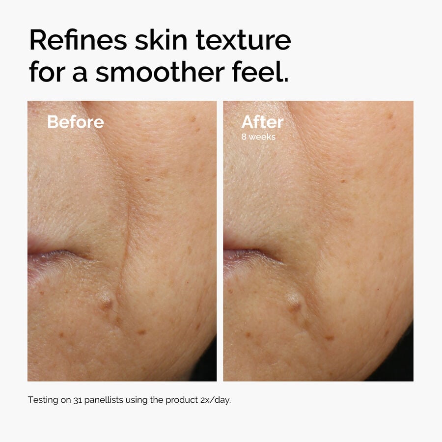 caffeine-3-escin-1-face-serum-i6 ord-caffeine-3pct-escin-1pct-face-serum-before-after-texture.jpg