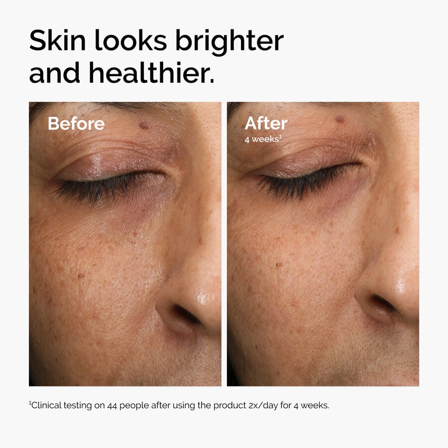 multi-antioxidant-radiance-serum-j0 ord-mars-before-after-healthy.jpg