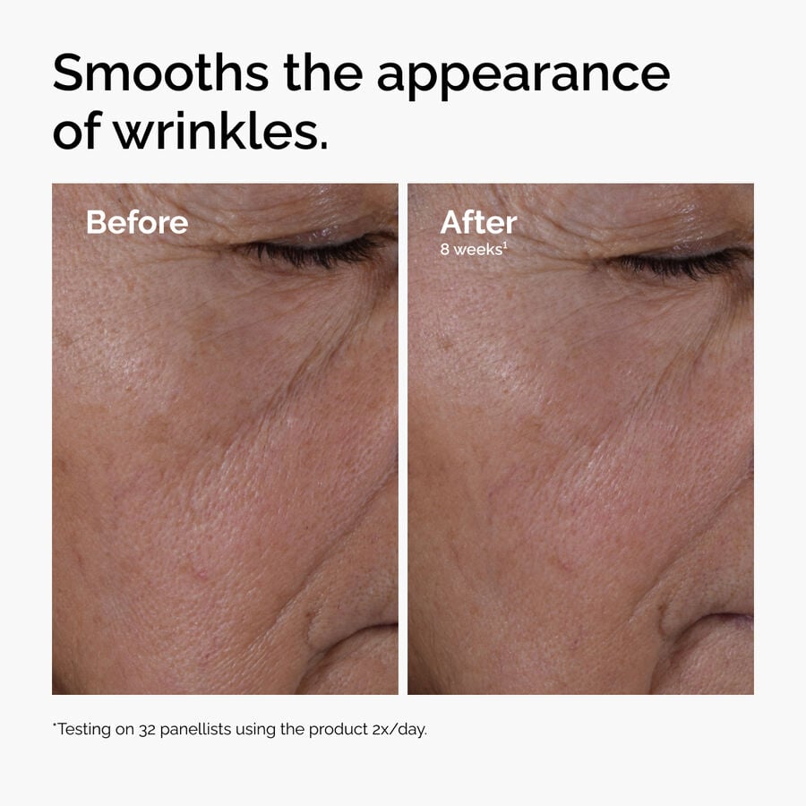 multi-peptide-ha-serum-d8 ord-multi-peptide-ha-serum-wrinkles-before-after.jpg