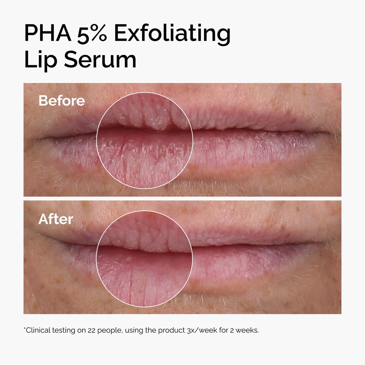 pha-5-exfoliating-lip-serum-z0 ord-pha-5pct-lip-exfoliating-serum-before-after.jpg