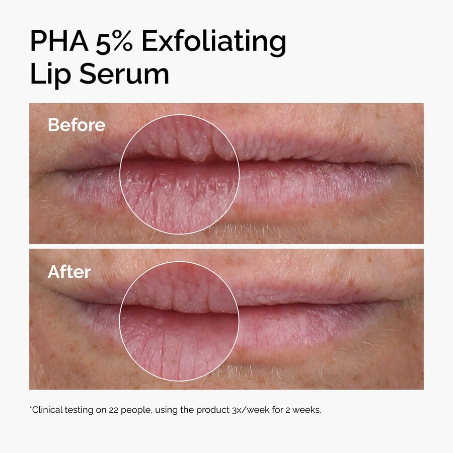 pha-5-exfoliating-lip-serum-z0 ord-pha-5pct-lip-exfoliating-serum-before-after.jpg