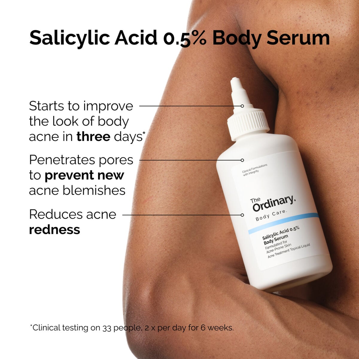 salicylic-acid-0-5-body-serum-s0 ord-salicylic-05-body-serum-otc-benefits-infographic.jpg